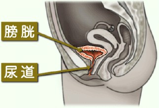 引起男性膀胱炎原因會有哪些